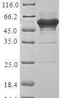 Human Lupus La protein (SSB) Recombinant Protein - BioCrest Sci
