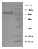 Mouse Proprotein convertase subtilisin/kexin type 5 (Pcsk5) Recombinant Protein - BioCrest Sci