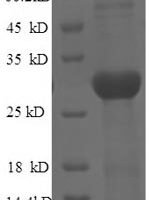 Mouse Tyrosine-protein kinase JAK3 (Jak3), partial Recombinant Protein, N-His, aa 818–1100, E.coli - BioCrest Sci