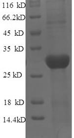 Mouse Tyrosine-protein kinase JAK3 (Jak3), partial Recombinant Protein, N-His, aa 818–1100, E.coli, Mus musculus (Mouse), E.coli, N-terminal 6xHis-tagged, 36.2 kDa, purity >≥ 90% as determined by SDS-PAGE.