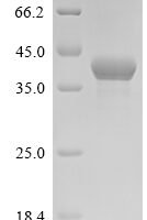 Escherichia coli DNA adenine methylase (dam) Recombinant Protein - BioCrest Sci
