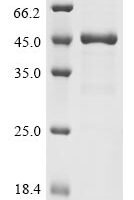 Human UPF0565 protein C2orf69 (C2orf69) Recombinant Protein, N-His - BioCrest Sci