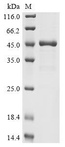 Human UPF0565 protein C2orf69 (C2orf69) Recombinant Protein, N-His, Homo sapiens (Human), E.coli, N-terminal 6xHis-tagged, 46.8 kDa, purity >≥ 85% as determined by SDS-PAGE.