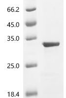 Human Tumor necrosis factor ligand superfamily member 10 (TNFSF10), partial Recombinant Protein, C-10His - BioCrest Sci