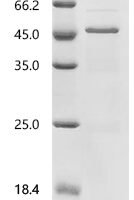Mouse Pituitary homeobox 1 (Pitx1) Recombinant Protein, C-His, aa 1–315, E.coli - BioCrest Sci