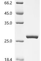Human Glutathione S-transferase A4 (GSTA4) Recombinant Protein, C-10His - BioCrest Sci