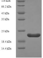 Rat Regenerating islet-derived protein 3-alpha (Reg3a) Recombinant Protein - BioCrest Sci