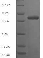 Human Collagen alpha-1 (IV) chain (COL4A1), partial Recombinant Protein, N-His-SUMO - BioCrest Sci