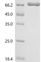 Human Protein-arginine deiminase type-1 (PADI1) Recombinant Protein, C-10His - BioCrest Sci