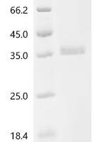 Human Tumor necrosis factor receptor superfamily member 6B (TNFRSF6B) Recombinant Protein, C-10His - BioCrest Sci