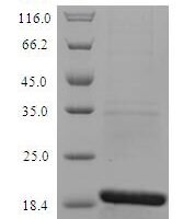 Dog Cholinesterase (BCHE) Recombinant Protein, N-His, aa 1–141, E.coli - BioCrest Sci