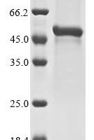 Mouse Fibroleukin (Fgl2) Recombinant Protein - BioCrest Sci