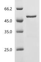 Human Choline-phosphate cytidylyltransferase A (PCYT1A) Recombinant Protein - BioCrest Sci