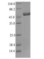Naja mossambica Snake venom metalloproteinase-disintegrin-like mocarhagin Recombinant Protein - BioCrest Sci