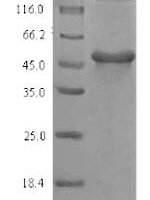 Glycine max  Gamma-glutamyl hydrolase Recombinant Protein - BioCrest Sci