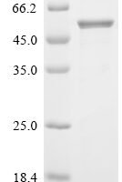 Human Calreticulin (CALR) Recombinant Protein, N-10His/C-Flag, aa 18–417, Yeast - BioCrest Sci