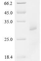 Mouse Oncostatin-M (Osm) Recombinant Protein, C-10His - BioCrest Sci