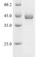 Human Nuclear receptor subfamily 2 group F member 6 (NR2F6) Recombinant Protein, Tag-Free - BioCrest Sci