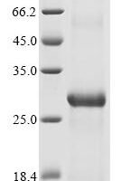 Bat coronavirus HKU9 Spike glycoprotein (S), partial Recombinant Protein - BioCrest Sci