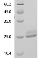 Human Somatotropin (GH1) Recombinant Protein, N-His - BioCrest Sci