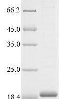 Rat Caprin family member 2 (Caprin2), partial Recombinant Protein - BioCrest Sci