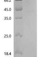 Rat Tyrosine-protein kinase receptor TYRO3 (Tyro3), partial Recombinant Protein, C-His - BioCrest Sci