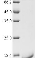 Mouse C-C chemokine receptor type 2 (Ccr2), partial Recombinant Protein - BioCrest Sci