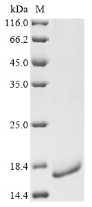 Mouse C-C chemokine receptor type 2 (Ccr2), partial Recombinant Protein, Mus musculus (Mouse), E.coli, N-terminal 10xHis-tagged and C-terminal Myc-tagged, 13.6 kDa, purity >≥ 90% as determined by SDS-PAGE.