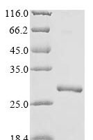 Human Non-selective voltage-gated ion channel VDAC1 (VDAC1), partial Recombinant Protein - BioCrest Sci