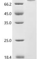 Human Peroxisomal multifunctional enzyme type 2 (HSD17B4) Recombinant Protein, N-His, aa 1–736, E.coli - BioCrest Sci