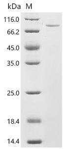 Human Peroxisomal multifunctional enzyme type 2 (HSD17B4) Recombinant Protein, N-His, aa 1–736, E.coli, Homo sapiens (Human), E.coli, N-terminal 6xHis-tagged, 86.6 kDa, purity >≥ 95% as determined by SDS-PAGE.