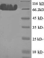 Human E3 ubiquitin-protein ligase MYLIP (MYLIP) Recombinant Protein, N-GST - BioCrest Sci