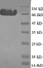 Human E3 ubiquitin-protein ligase MYLIP (MYLIP) Recombinant Protein, N-GST, Homo sapiens (Human), E.coli, N-terminal GST-tagged, 76.9 kDa, purity >≥ 90% as determined by SDS-PAGE.