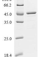 Human Acetyl-CoA acetyltransferase, mitochondrial (ACAT1) Recombinant Protein, N-10His/C-Myc - BioCrest Sci