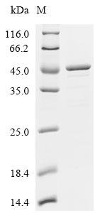 Human Acetyl-CoA acetyltransferase, mitochondrial (ACAT1) Recombinant Protein, N-10His/C-Myc, Homo sapiens (Human), E.coli, N-terminal 10xHis-tagged and C-terminal Myc-tagged, 46.4 kDa, purity >≥ 85% as determined by SDS-PAGE.