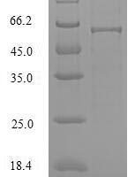 Saccharomyces cerevisiae Hexokinase-1 (HXK1), partial Recombinant Protein, N-His, aa 2–485, E.coli - BioCrest Sci