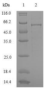 Saccharomyces cerevisiae Hexokinase-1 (HXK1), partial Recombinant Protein, N-His, aa 2–485, E.coli, Saccharomyces cerevisiae (strain ATCC 204508 / S288c) (Baker's yeast), E.coli, N-terminal 6xHis-tagged, 57.6 kDa, purity >≥ 90% as determined by SDS-PAGE.