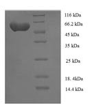 Human Serine/threonine-protein kinase NIM1 (NIM1) Recombinant Protein - BioCrest Sci
