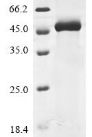 Human Antithrombin-III (SERPINC1), partial Recombinant Protein - BioCrest Sci