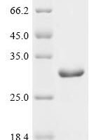 Shigella sonnei LPS-assembly protein lptD (lptD), partial Recombinant Protein - BioCrest Sci