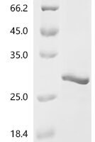 Mouse Cold-inducible RNA-binding protein (Cirbp) Recombinant Protein - BioCrest Sci