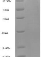Human Mannan-binding lectin serine protease 1 (MASP1) Recombinant Protein, N-His-SUMO - BioCrest Sci