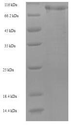 Human Mannan-binding lectin serine protease 1 (MASP1) Recombinant Protein, N-His-SUMO, Homo sapiens (Human), E.coli, N-terminal 6xHis-SUMO-tagged, 93.0 kDa, purity >≥ 90% as determined by SDS-PAGE.