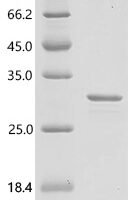 Bradyrhizobium sp. Chitooligosaccharide deacetylase (nodB) Recombinant Protein, N-GST - BioCrest Sci