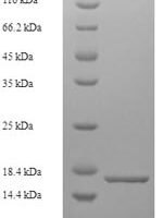 Mouse D-dopachrome decarboxylase (Ddt) Recombinant Protein, N-His, aa 2–118, E.coli - BioCrest Sci