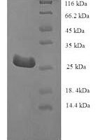 Human Telomerase protein component 1 (TEP1), partial Recombinant Protein - BioCrest Sci