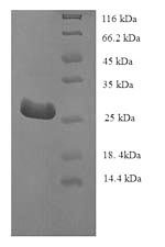 Human Telomerase protein component 1 (TEP1), partial Recombinant Protein, Homo sapiens (Human), E.coli, N-terminal 6xHis-tagged, 26.8 kDa, purity >≥ 90% as determined by SDS-PAGE.