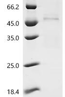 Pig Caveolin-3 (CAV3) Recombinant Protein - BioCrest Sci