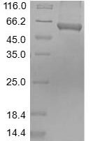 Mouse Pyruvate kinase PKM (Pkm) Recombinant Protein - BioCrest Sci