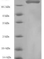 Human Heterogeneous nuclear ribonucleoprotein L (HNRNPL) Recombinant Protein - BioCrest Sci